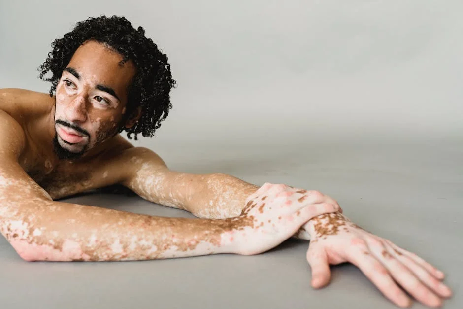 Mercado Tratamento de Vitiligo 2022 Participacao Tamanho Analise de Tendencias e Previsao Para 2028 2 — mercados